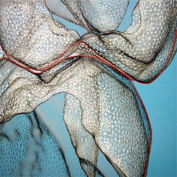 Odontologia digital torremolinos